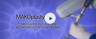 MAKOplasty Procedure